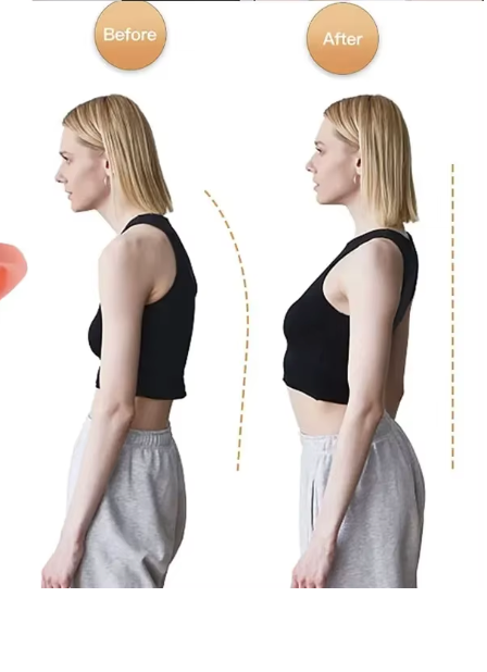 Apex Form™ Smart Posture Trainer